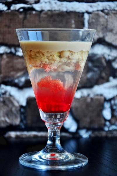 Brain Hemorrhage Brain Hemorrhage