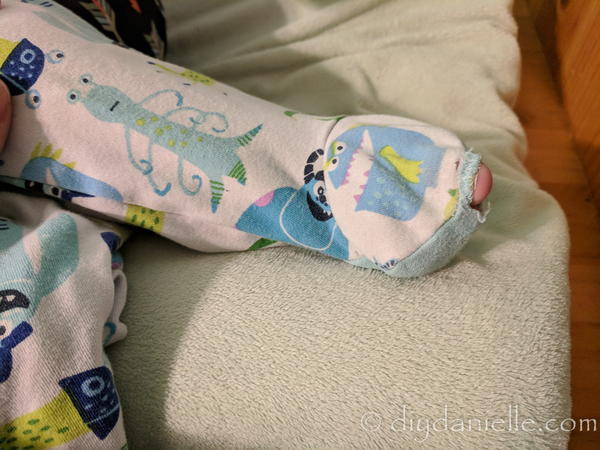 How to Fix Holes in Footie PJs How to Fix Holes in Footie PJs