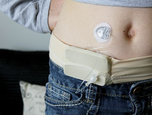 DIY Insulin Pump Band DIY Insulin Pump Band