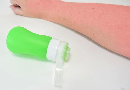 Cooling and Soothing DIY Sunburn Relief